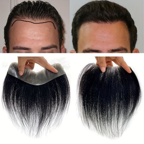 Front Hair Patch || Front Patti